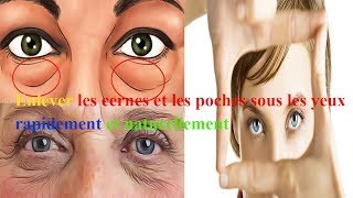 Enlever les cernes et les poches sous les yeux rapidement et naturellement astuce miracle [upl. by Yseulta328]