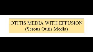 OTITIS MEDIA WITH EFFUSION [upl. by Yezdnil]