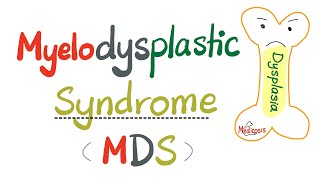 Myelodysplastic Syndrome MDS  a precursor to Acute Myeloid Leukemia AML   Hematology Series [upl. by Eatnuahs]