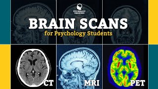 BRAIN SCANS FOR PSYCHOLOGY STUDENTS  CT MRI fMRI PET  Neuroscience [upl. by Torray]