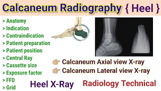 Calcaneum Radiography Heel Xray  Axial view xray  Heel lateral view Xray radiography [upl. by Ginzburg686]