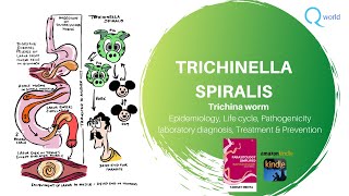 Trichinella Spiralis Parasitology simplified tutorials For NEXT USMLE NEET PG PLAB [upl. by Bala]