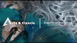 ►Irrigación en Endodoncia  Dr David Carmona Herrera [upl. by Moorish671]