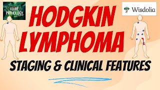 HODGKIN LYMPHOMA  Staging Clinical Features  Treatment Prognosis [upl. by Alyos4]