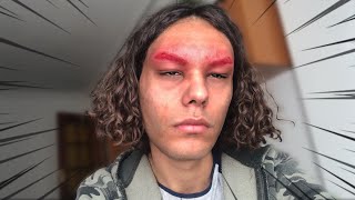 QUEMADURA DE PRIMER GRADO POR DECOLORAR LA CEJAS 😱 CUIDADO 😭😭 [upl. by Aneras]