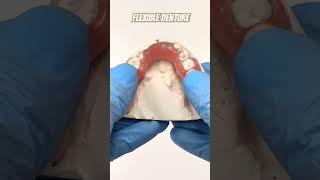 Flexible Denture 😃👍indradentalvlogs flexibledenture shorts [upl. by Stephan356]