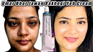 How I Use Tretinoin to Keep My Skin Youthful and WrinkleFree  Indian Youtuber Anmol [upl. by Gnap]