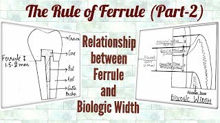 Ferrule Effect Part2 Relationship between Ferrule and Biologic Width [upl. by Latini]