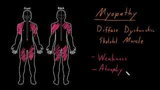 Syndrome Myopathy [upl. by Quiteris402]