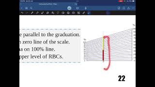 Hematocrit value  Practical hematology  Dr Saiko [upl. by Gaivn]