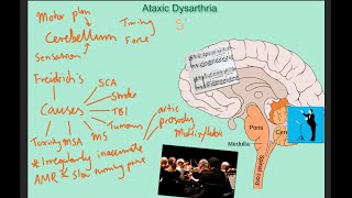 Ataxic dysarthria  samples and explanation [upl. by Phylis]