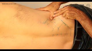 Trigger Point Release for Back Pain Quadratus Lumborum QL [upl. by Gervase]