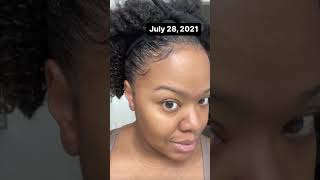 Watch Me Regrow My Edges using the Follicle Stimulating Serum by JAntoinette 1927 regrowhairline [upl. by Sanferd]