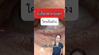 ตากระตุก หมอกิ๊ก จักษุแพทย์ ophthalmologist เปลือกตากระตุก ตากระตุก eyelidtwitch myokymia [upl. by Stranger]