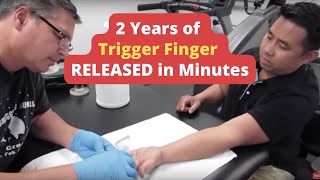 2 Years of  Trigger Finger  RELEASED in Minutes REAL RESULTS [upl. by Jeni]