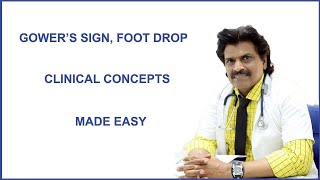 GOWERS SIGN FOOT DROP CLINICAL CONCEPTS MADE EASY [upl. by Terrej755]