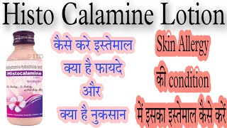 Histo calamine lotion uses in hindi स्किन एलर्जी की लोशन दवा skin allergy ki lotion dawaa [upl. by Yortal]