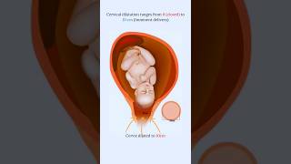 Effacement and Dilatation 🤔fetus share foryou [upl. by Bianca]