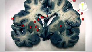 Configuración Interna del Cerebro Primera Parte [upl. by Ydnir]