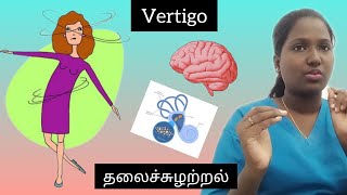 Vertigo  தலைச்சுழற்றல்  In Tamil vertigo physiotherapy treatment dizziness health neurology [upl. by Avi652]