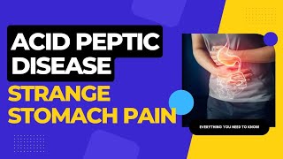 Acid Peptic Disease Dr Rajeev Sharma english acidpepticdiseaseacidity medicine [upl. by Neih908]