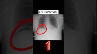 X ray quiz 37 nursing nursingstudent doctor USMLE MBBS hospital anatomy ctscan radiology [upl. by Naols]