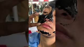 charcoal peel off mask  peel off mask blackhead and whitehead remove [upl. by Aseeram64]