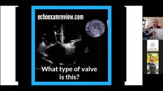 Prosthetic Heart Valves [upl. by Maryellen]