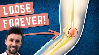 How to Permanently Loosen a Tight Ulnar Nerve [upl. by Eng]