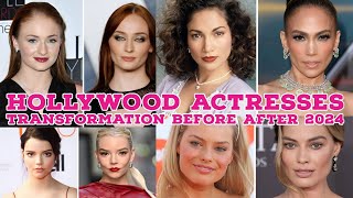 Cheekbone Glow Up  Celebrities  Before and After  Surgery  Hollywood Actresses [upl. by Sybille]