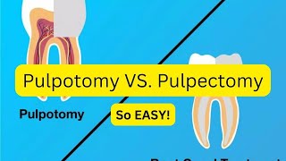 Difference between pulpotomy and pulectomy and STEPS [upl. by Mayes]