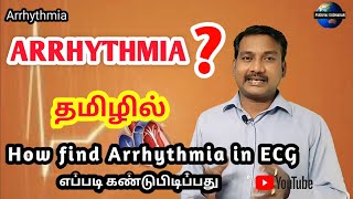 Arrhythmia in tamil  abnormal ECG in tamil  heart block  missed beat [upl. by Epoillac]