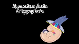 Agenesis Aplasia and Hypoplasia [upl. by Thamos280]