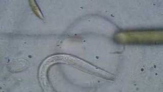 Deadly Worms – A look at Soil Transmitted Helminths [upl. by Alliehs]