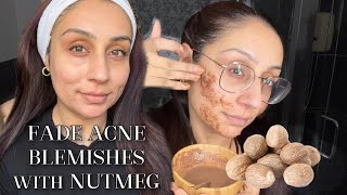 DIY Nutmeg amp Milk Mask for blemishes acne pigmentation [upl. by Lusa876]