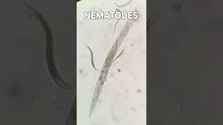 Nematodes  Agriculture  Nematology nematodes Nematology agriculture viralshort viralshorts [upl. by Abert700]