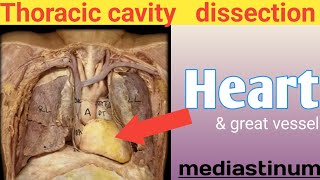 Heart dissection ❤ real human body Mediastinum thoracic cavity anatomy internal organs [upl. by Allayne854]