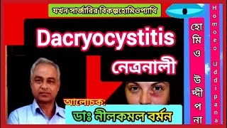 Dacryocystitis  নেত্রনালী  যখন সার্জারির বিকল্প হোমিওপ্যাথি  পর্ব ৭  Part 7  ডাঃ নীলকমল বর্মন [upl. by Dnomhcir992]