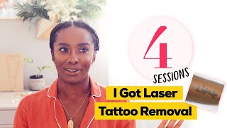 Amazing Laser Tattoo Removal Results [upl. by Lalitta471]