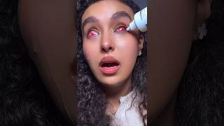 Part 2 😱 trying to remove sclera lenses 🧟‍♀️ nouhailaait [upl. by Rochemont]