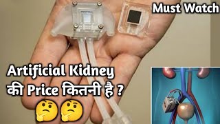 Artificial Kidney Launched  What Is Its Price   fact shorts facttv kidney artificial [upl. by Levona]