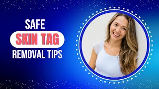 Safe SkinTag Removal Tips [upl. by Yboc]