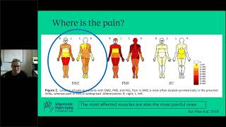 AsktheExpert Myotonic Dystrophy Type 2 amp Pain Management [upl. by Nerrej]