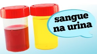 O QUE SIGNIFICA SANGUE NA URINA [upl. by Eatnoled]