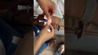 Iv cannula technique iv cannula kaise lagaya jata hai shortfeed viralreel trend video cannula [upl. by Lednar]