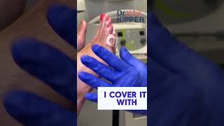 5th Toe Corn Pad  and debridement  Part 2 CornPad Debridement drnailnipper [upl. by Redyr]