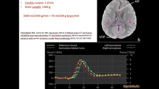 64 CT perfusion and MR perfusion cerebral blood flow cerebral blood volume DCE DSC [upl. by Eniamerej808]