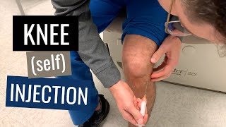 Knee Injection Steroid Technique Blind Anterolateral Approach [upl. by Abelard652]