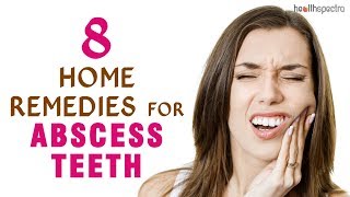 8 Home Remedies for Abscess Teeth [upl. by Souza774]