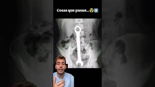 Objetos homologados IG victorgonzalezgonzalez curiosidades sabiasque [upl. by Kauffmann17]